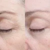 Bioeffect Kasvojenhoito<30 day treatment tehohoito 3 kpl