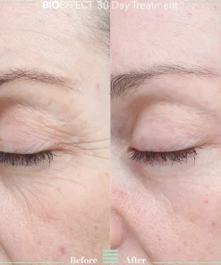 Bioeffect Kasvojenhoito<30 day treatment tehohoito 3 kpl