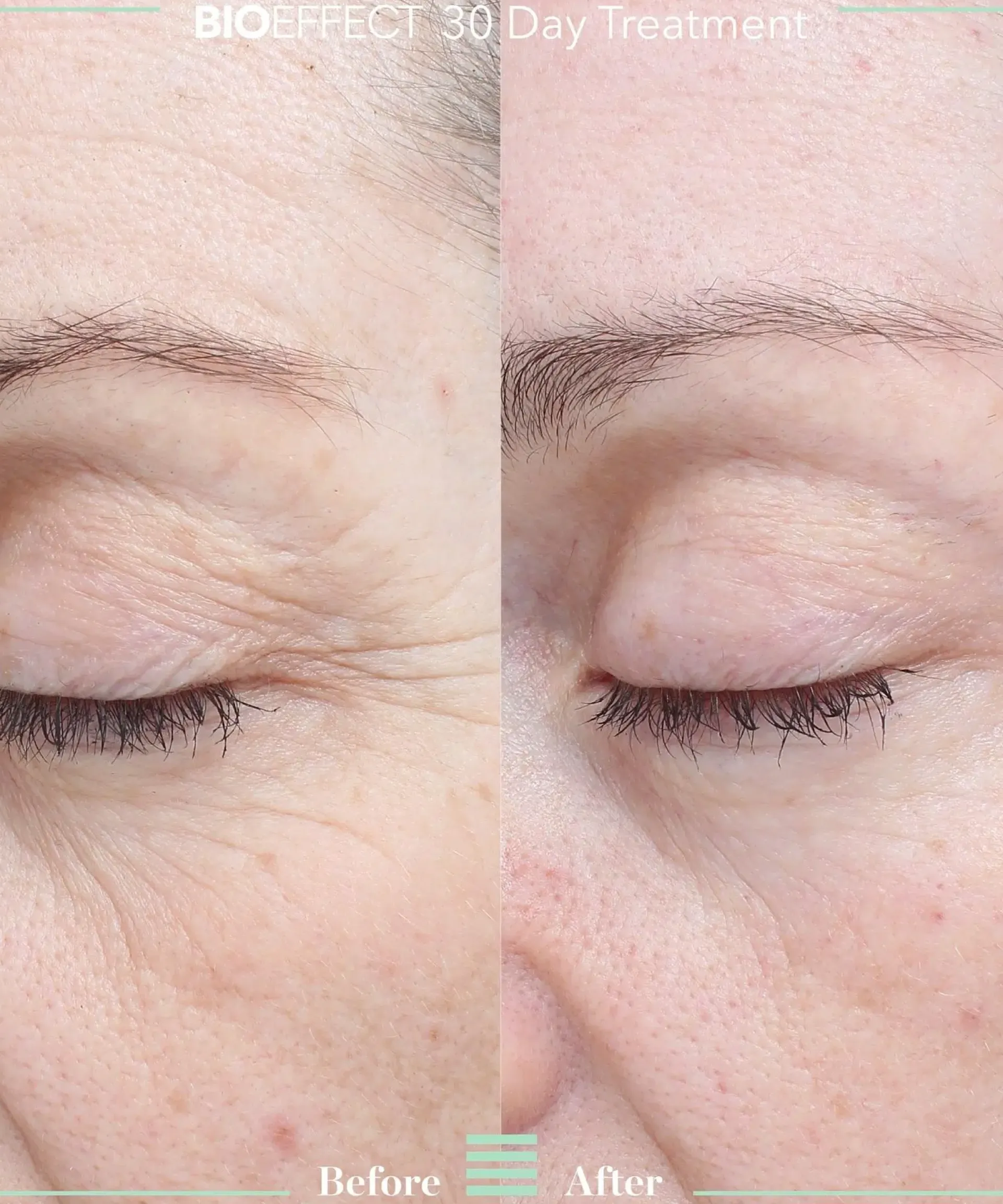 Bioeffect Kasvojenhoito<30 day treatment tehohoito 3 kpl