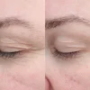 Bioeffect Kasvojenhoito<EGF Eye Serum silmänympärysseerumi 6ml