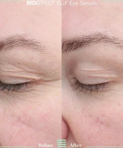 Bioeffect Kasvojenhoito<EGF Eye Serum silmänympärysseerumi 6ml