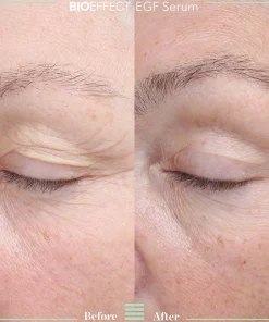 Bioeffect Ihonhoidon Tehoaineet|Kasvojenhoito<EGF Serum seerumi 15ml