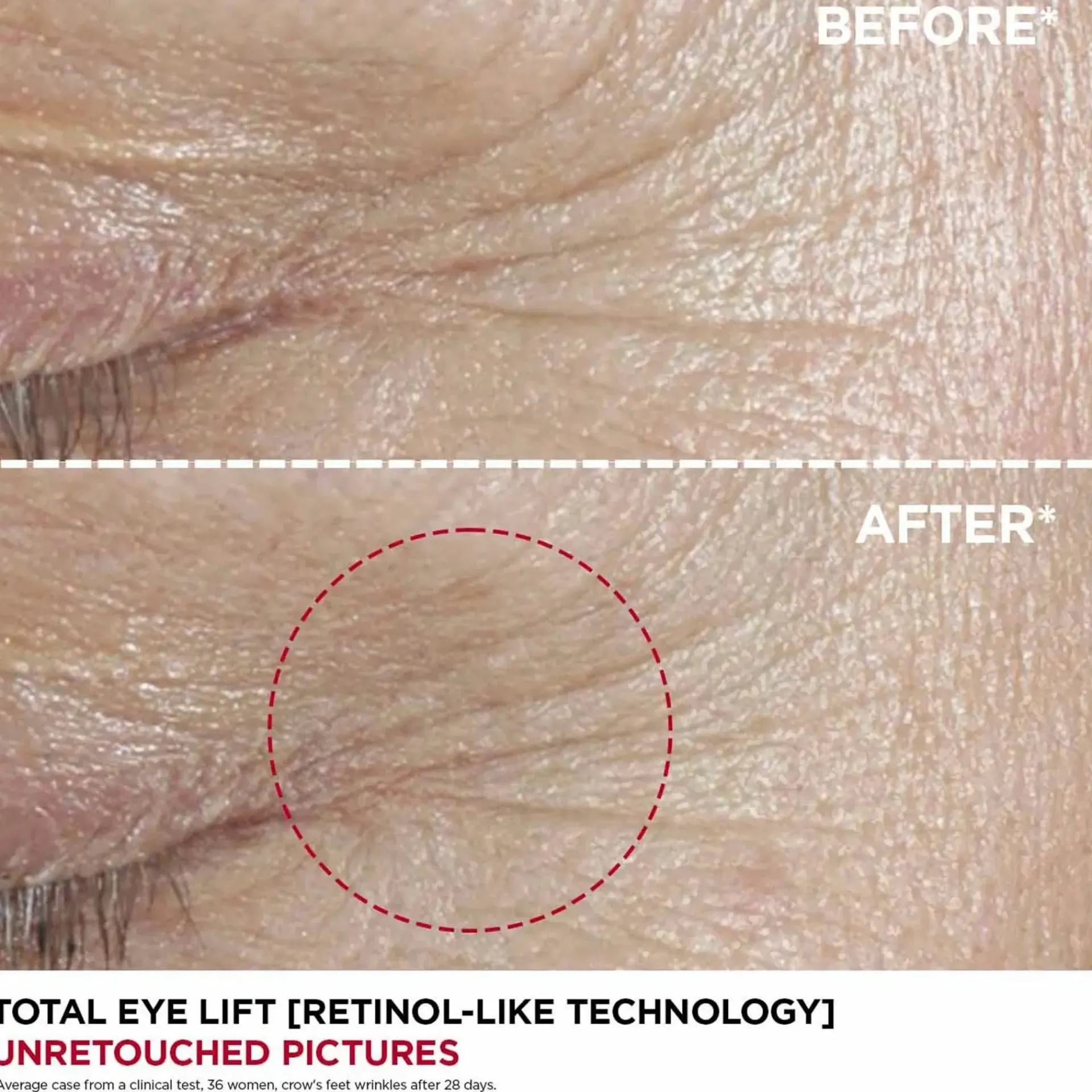 Clarins Kasvojenhoito<Total eye lift silmänympärysvoide 15ml