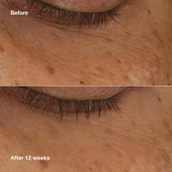 Clinique Kasvojenhoito<All About Eyes Brightening Serum Concentrate silmänympärysseerumi 10 ml