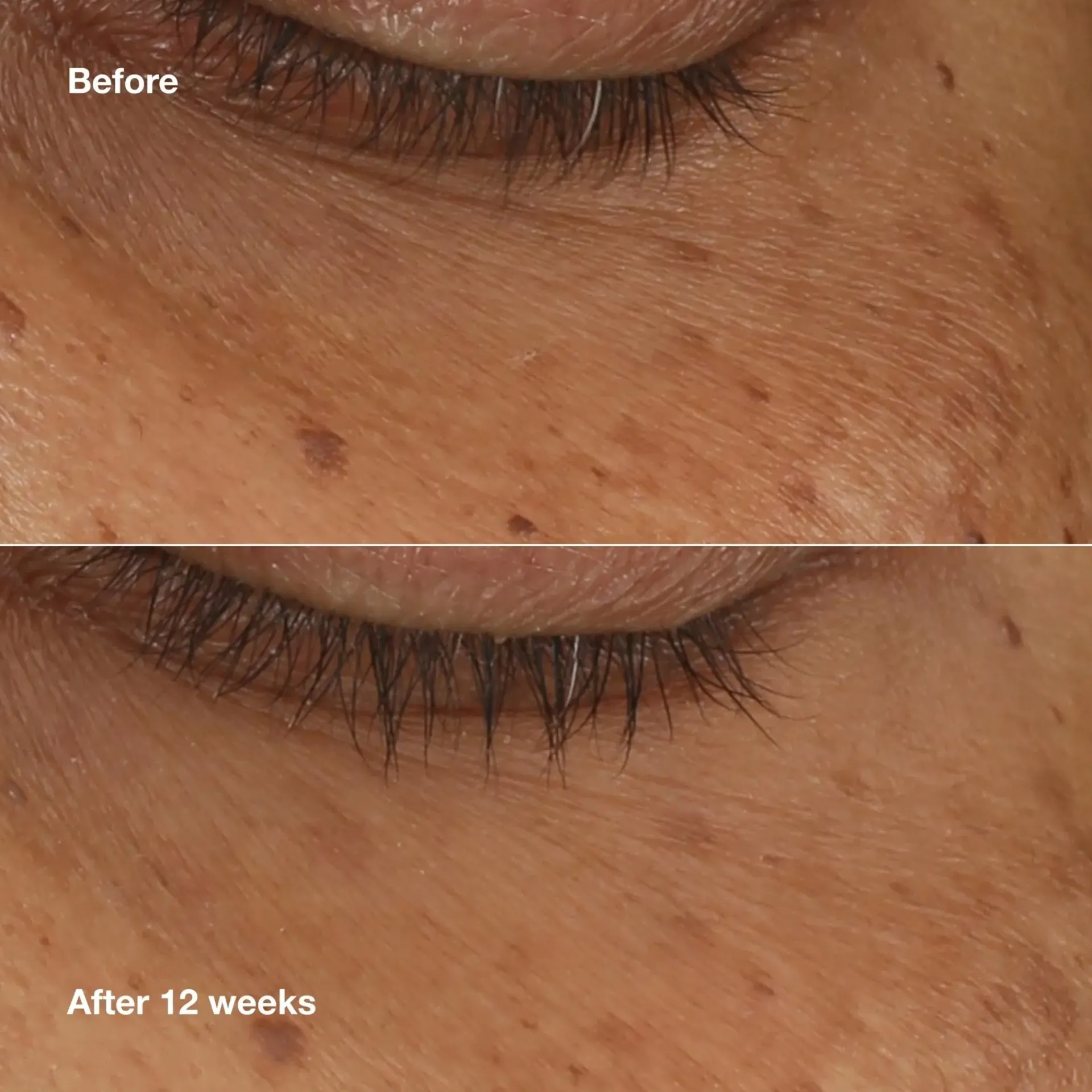 Clinique Kasvojenhoito<All About Eyes Brightening Serum Concentrate silmänympärysseerumi 10 ml