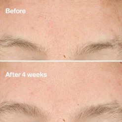 Clinique Hajusteettomat Ihonhoidon Tuotteet|Kasvojenhoito<Clarifying Do-Over Peel kuorintavoide 30 ml