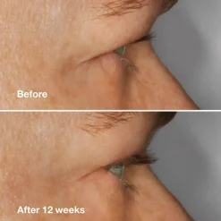 Clinique Hajusteettomat Meikit|Silmämeikit<High Impact Lash Amplifying Serum ripsiseerumi 3 ml