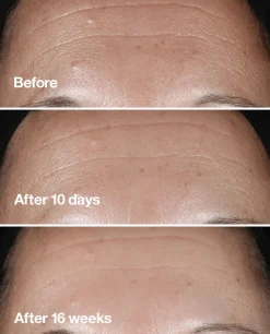 Clinique Hajusteettomat Ihonhoidon Tuotteet|Ihonhoidon Tehoaineet<Smart Clinical Repair Seerumi 50 ml