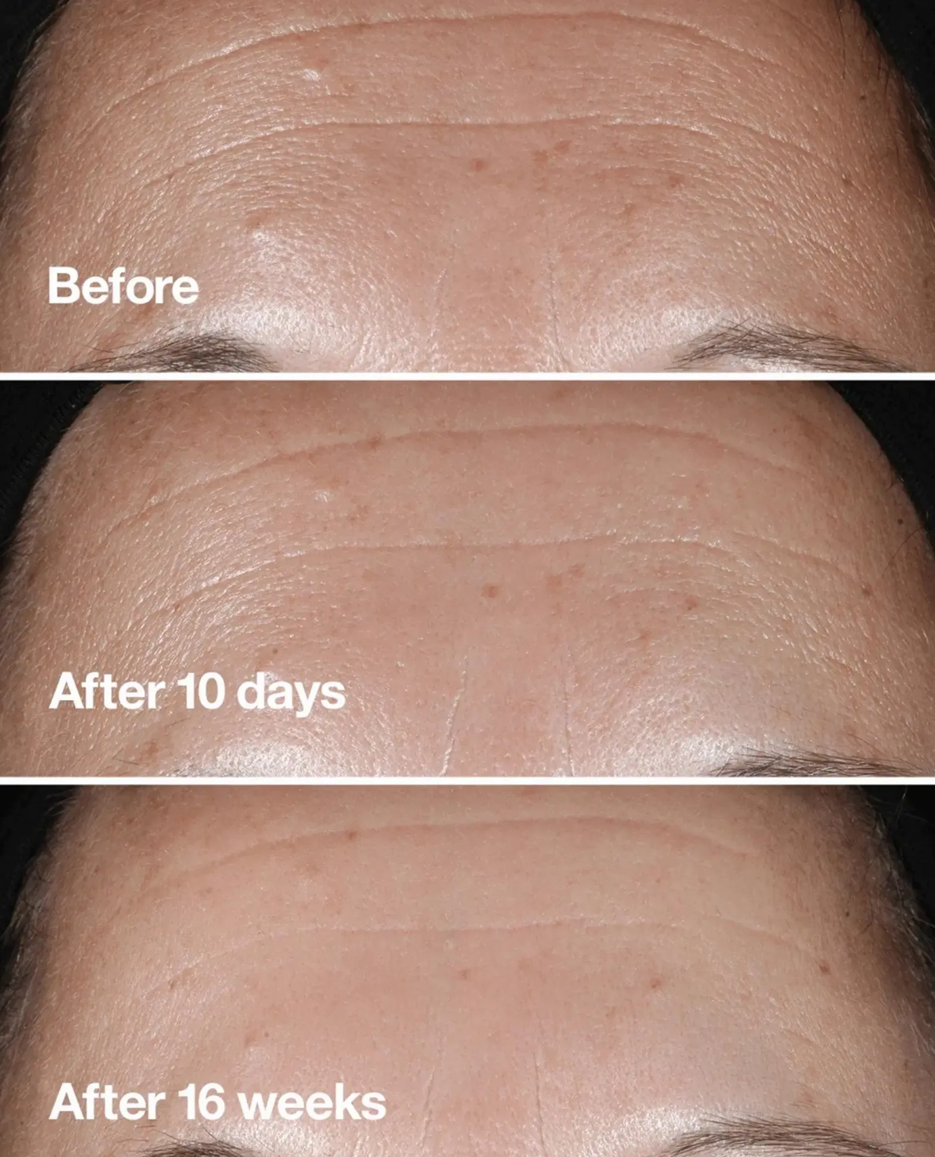 Clinique Hajusteettomat Ihonhoidon Tuotteet|Ihonhoidon Tehoaineet<Smart Clinical Repair Seerumi 50 ml