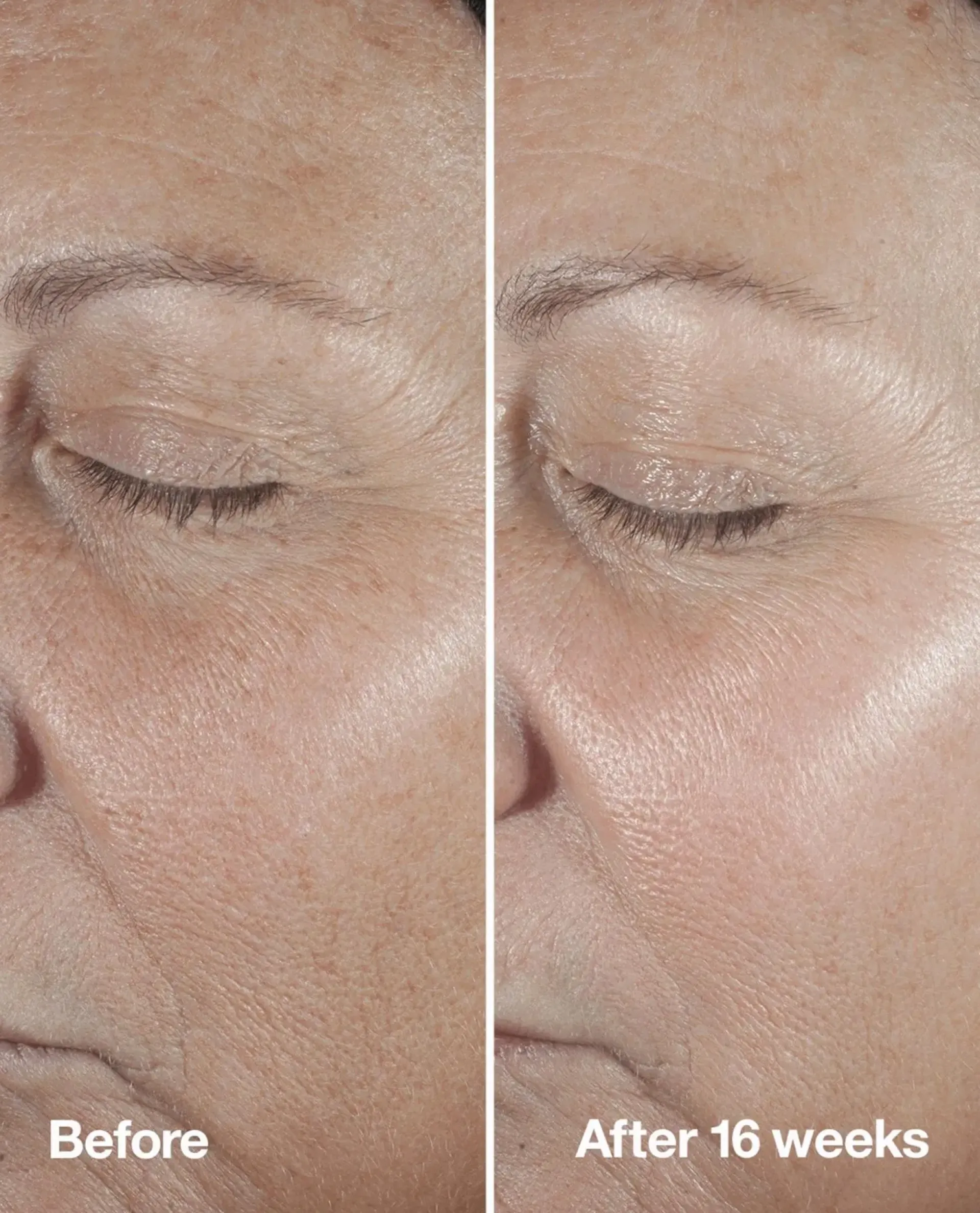 Clinique Hajusteettomat Ihonhoidon Tuotteet|Ihonhoidon Tehoaineet<Smart Clinical Repair Seerumi 50 ml