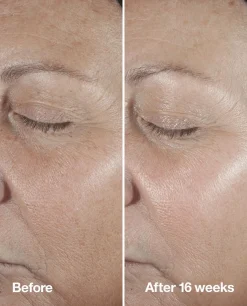 Clinique Hajusteettomat Ihonhoidon Tuotteet|Kasvojenhoito<Smart Clinical Repair Seerumi 30 ml