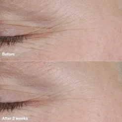 Clinique Ihonhoidon Tehoaineet|Kasvojenhoito<Smart Clinical Repair AM/PM Retinoid Balm täsmähoitotuote 3 g