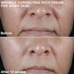 Clinique Hajusteettomat Ihonhoidon Tuotteet|Ihonhoidon Tehoaineet<Smart Clinical Repair Wrinkle Correcting Rich Cream kosteusvoide 50 ml