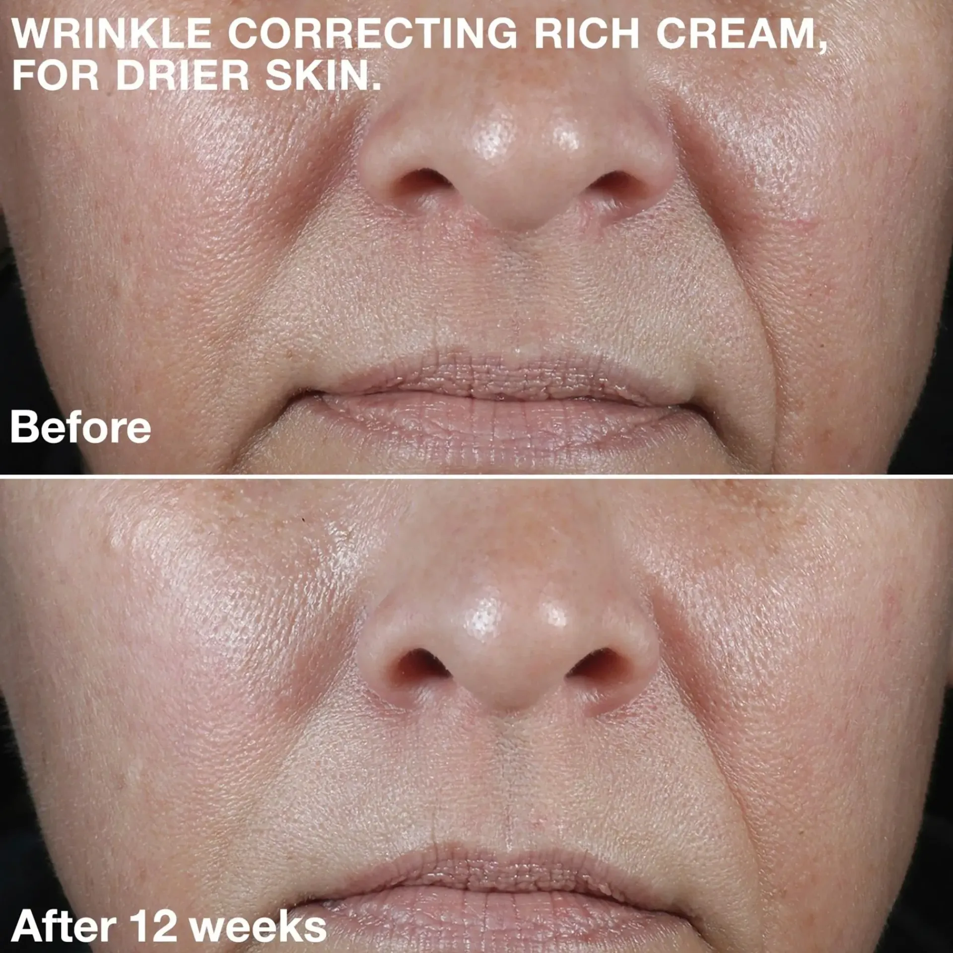 Clinique Hajusteettomat Ihonhoidon Tuotteet|Ihonhoidon Tehoaineet<Smart Clinical Repair Wrinkle Correcting Rich Cream kosteusvoide 50 ml