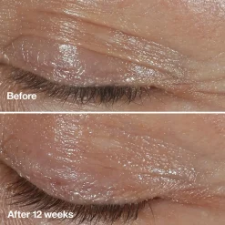 Clinique Ihonhoidon Tehoaineet|Kasvojenhoito<Smart Clinical Repair Wrinkle Correcting Eye Cream silmänympärysvoide 15 ml