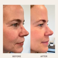 Evolve Organic Beauty Ihonhoito|Kasvojenhoito<Age Defying Lifting kasvoseerumi 30ml
