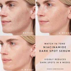 Fenty Skin Kasvojenhoito<Watch Ya Tone Niacinamide Dark Spot Serum Refill seerumi täyttöpakkaus 30 ml