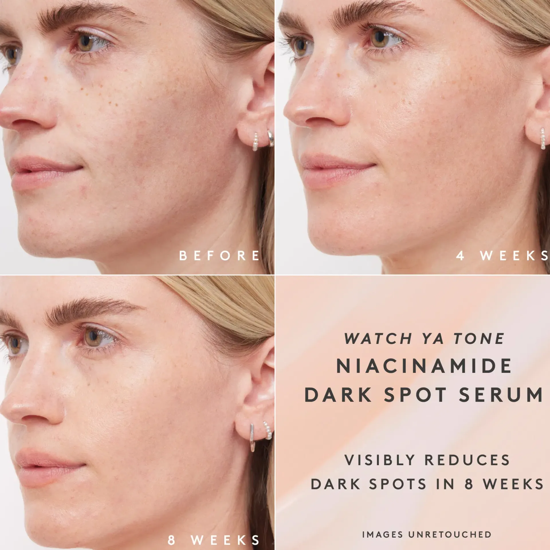 Fenty Skin Kasvojenhoito<Watch Ya Tone Niacinamide Dark Spot Serum Refill seerumi täyttöpakkaus 30 ml