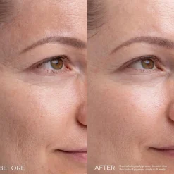 MÁDARA Ihonhoito|Kasvojenhoito<MADARA KOJIC ALTERNATIVE Pigment -seerumi 30ml