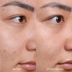 Ole Henriksen Ihonhoidon Tehoaineet|Kasvojenhoito<OleHenriksen Truth Banana Bright ™ Vitamin C seerumi 30 ml