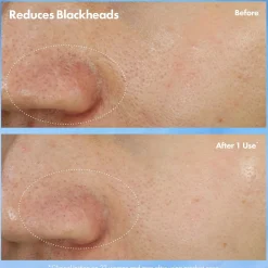 Origins Kasvojenhoito<Clear Improvement Blackhead Clearing Mask-To-Scrub kuorintanaamio 75 ml