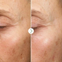 Pai Skincare Ihonhoito|Kasvojenhoito<Pai Fade Forward Dark spot seerumi 30ml