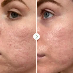 Pai Skincare Ihonhoito|Kasvojenhoito<Pai Hyaluronic Acid 0.3% Hydrating booster seerumi 10ml