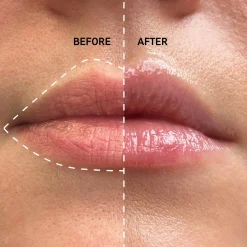 The INKEY List Kasvojenhoito<Tripeptide Plumping Lip Balm huulivoide 10 ml