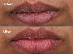 The Ordinary Kasvojenhoito<PHA 5% Exfoliating Lip Serum huuliseerumi 15 ml
