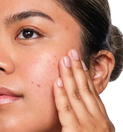 The Ordinary Kasvojenhoito<Salicylic Acid 2% Solution liuos 30 ml