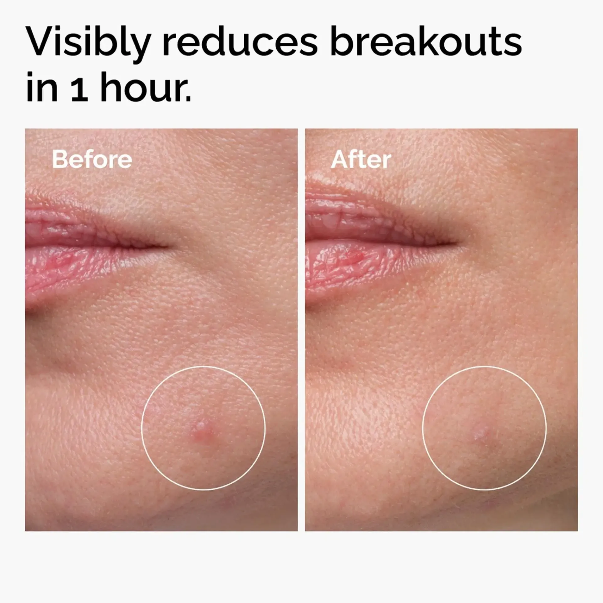 The Ordinary Kasvojenhoito<Sulfur 10% Powder-to-Cream Concentrate täsmätuote epäpuhtauksille 5g